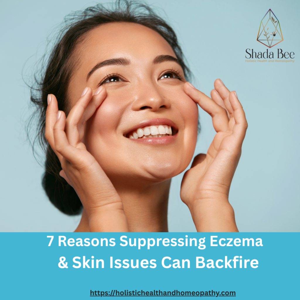 Homeopathy for Eczema