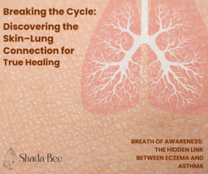 Eczema and asthma are connected through the skin and lungs, natural healing